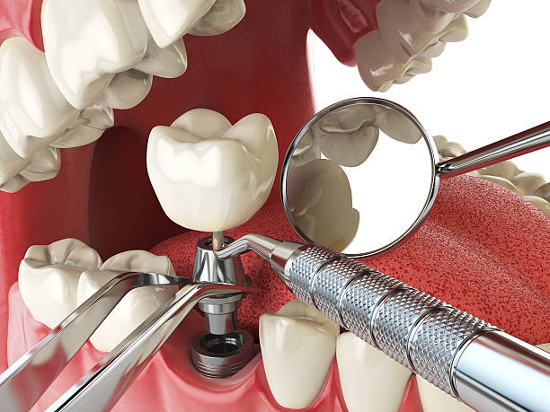 Best Orthodontic Emergency Dentist in North Pekin, IL